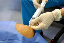 Kemik Sıvısı Özellikleri ve Faydaları Nelerdir? Kemik Sıvısı Özellikleri ve Faydaları Nelerdir?